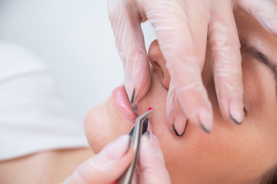 Todo acerca de los servicios de depilación en Arca, O Pino